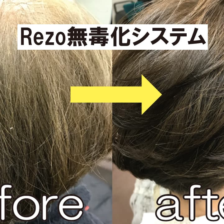 レゾシステム